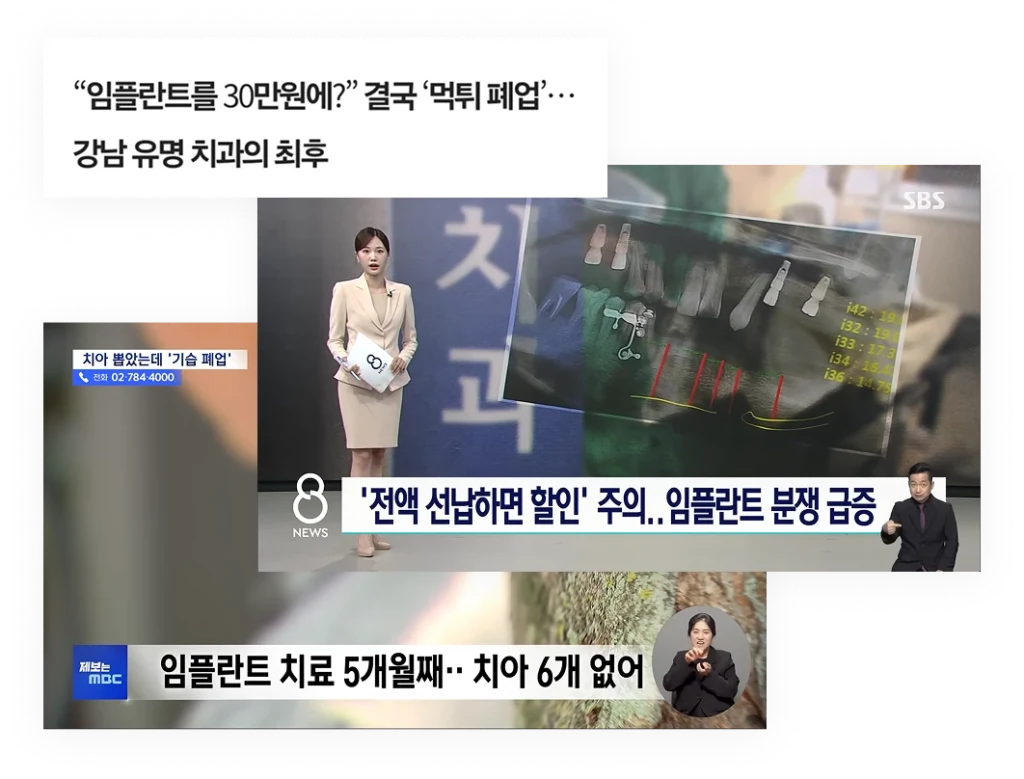 임플란트 분쟁 기사 사진