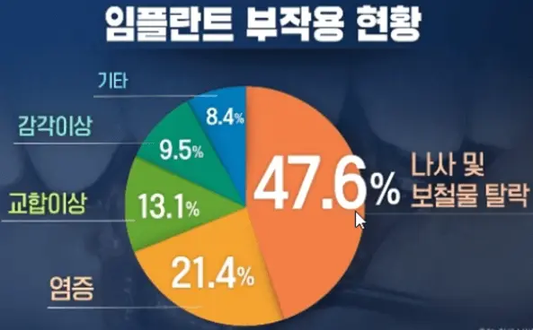 임플란트 부작용 현황